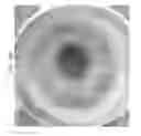 Fig. 85 - Prosthetic capsular devices, systems, and methods