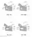 Fig. 08 - Dual optic, curvature changing accommodative IOL having a fixed disaccommodated refractive state