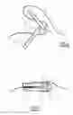Fig. 06 - Device for treating a body tissue, and associated treatment kit