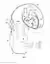 Fig. 02 - CARDIAC ASSISTANCE DEVICE