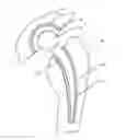 Fig. 01 - Orthopedic device and polymer compositions for making same