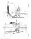 Fig. 07 - Knee joint prosthesis and related method