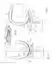Fig. 09 - Knee joint prosthesis and related method