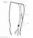 Fig. 07 - VESSEL REMODELING METHODS AND DEVICES FOR USE IN A GRAFT DEVICE