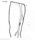 Fig. 08 - VESSEL REMODELING METHODS AND DEVICES FOR USE IN A GRAFT DEVICE