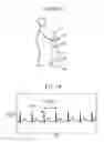 Fig. 08 - Walking assistance robot for assisting smooth start of user's action after standing up from chair