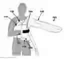Fig. 01 - MITT FOR COMPRESSION GARMENTS