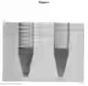 Fig. 02 - MEANS AND METHODS FOR PREVENTING AND/OR TREATING CARIES