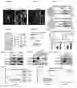 Fig. 02 - Methods for treating brain metastasis