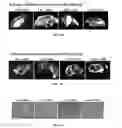Fig. 08 - Methods and compositions to reduce oxidative stress