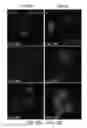 Fig. 10 - Pancreatic stem cells and uses thereof