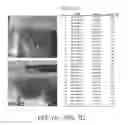 Fig. 12 - Pancreatic stem cells and uses thereof