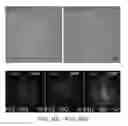 Fig. 19 - Pancreatic stem cells and uses thereof