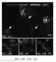 Fig. 25 - Pancreatic stem cells and uses thereof
