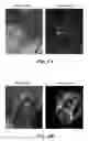 Fig. 07 - Topical application of nerve labeling dyes for image-guided surgery