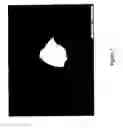 Fig. 08 - Porous Structures of Microbial-Derived Cellulose In Vivo Implantation