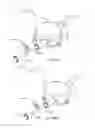Fig. 35 - Blood pump systems and methods
