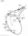 Fig. 06 - Catheter holder and catheter set