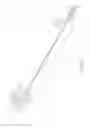 Fig. 06 - Axial lengthening thrombus capture system