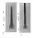 Fig. 104 - Axial lengthening thrombus capture system