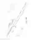 Fig. 22 - Axial lengthening thrombus capture system