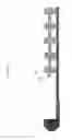 Fig. 83 - Axial lengthening thrombus capture system