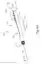 Fig. 08 - Dilation catheter assembly with adjustment features