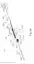 Fig. 32 - Dilation catheter assembly with adjustment features