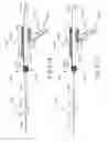 Fig. 45 - Dilation catheter assembly with adjustment features