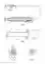 Fig. 02 - Balloon catheter and method of making same