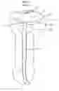 Fig. 02 - Stretch valve balloon catheter and methods for producing and using same