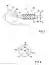 Fig. 02 - Delivery systems for an intravascular electrode line and corresponding delivery methods and catheters