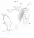 Fig. 03 - Transcranial neurostimulation system for a vehicle