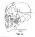 Fig. 07 - Devices, systems and methods for treatment of neuropsychiatric disorders