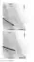 Fig. 07 - MICROFLUIDIC PARTICLE SORTER