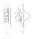 Fig. 02 - Component having wear-protected openings and recesses and process for the production thereof