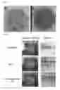 Fig. 03 - Method for preparing a three-dimensionally cultured skin comprising dermis and epidermis, and the cultured skin made therefrom