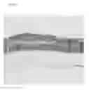 Fig. 07 - Method for preparing a three-dimensionally cultured skin comprising dermis and epidermis, and the cultured skin made therefrom