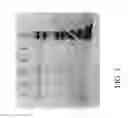 Fig. 04 - METHODS FOR PRODUCING PREPARATIONS OF RECOMBINANT AAV VIRIONS SUBSTANTIALLY FREE OF EMPTY CAPSIDS
