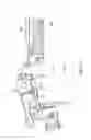 Fig. 03 - REMOVABLE COMPACT HINGE AND METHOD OF USE
