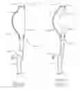 Fig. 16 - Flexible fluidic mirror and hybrid system