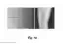 Fig. 02 - SYSTEMS AND METHODS FOR IMAGE-BASED QUANTIFICATION FOR ALLERGEN SKIN REACTION