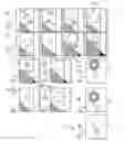 Fig. 01 - Digital subtraction angiography