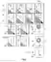 Fig. 03 - Digital subtraction angiography