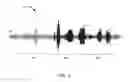 Fig. 02 - Analog voice activity detection