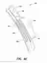 Fig. 06 - Compliant constrained headband spring