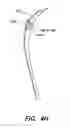 Fig. 09 - Compliant constrained headband spring