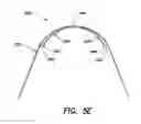 Fig. 14 - Compliant constrained headband spring