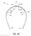 Fig. 15 - Compliant constrained headband spring