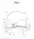 Fig. 05 - HEAD SET AND HEAD SET APPARATUS